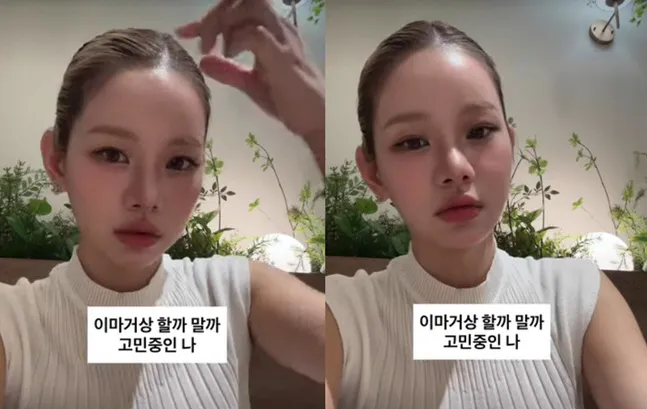 Comedian Meng Seung-ji Reconsiders Forehead Augmentation After Previous Cosmetic Procedure Regret Comedian Meng Seung-ji Reconsiders Forehead Augmentation After Previous Cosmetic Procedure Regret